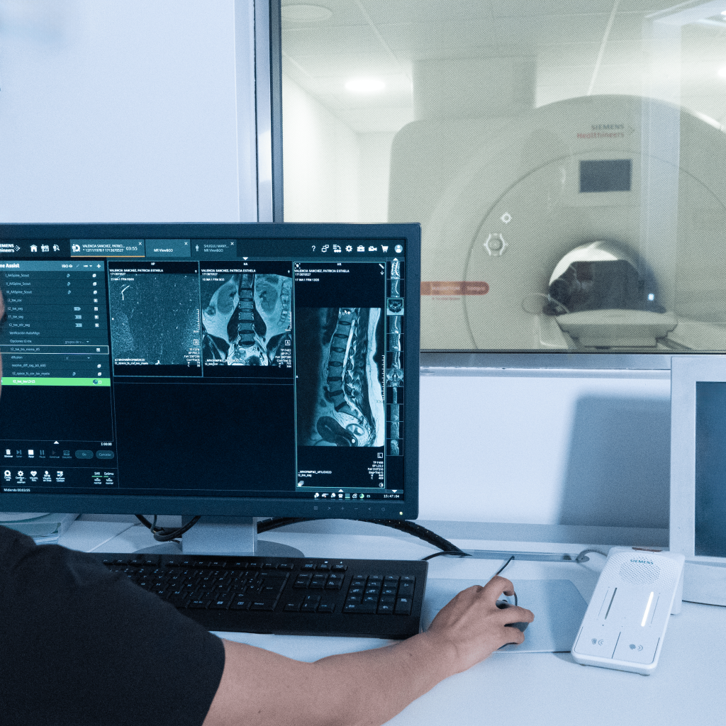 resonancia magnética